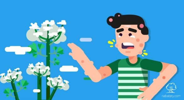 نباتات الزينة السامة